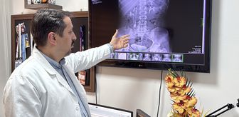 İdrar kanalından çıkan 51 taş, doktorları bile şaşkına çevirdi