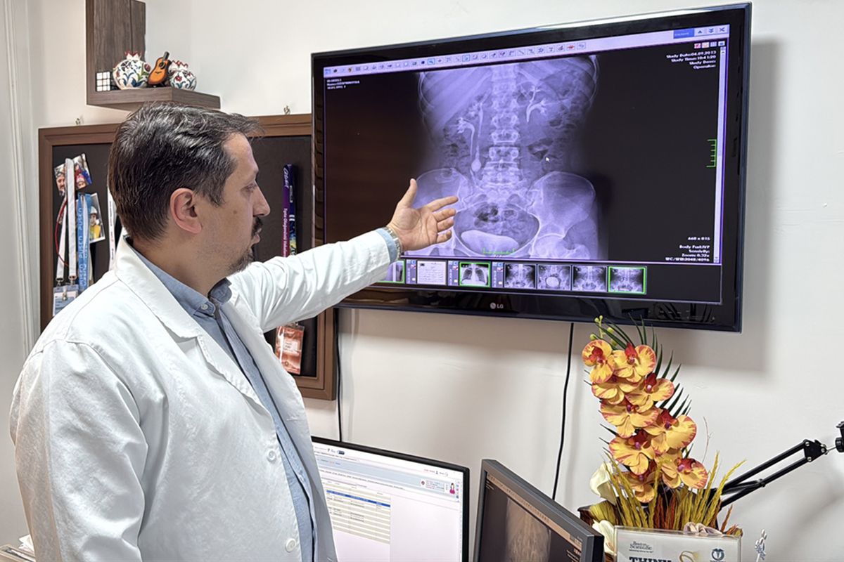 İdrar kanalından çıkan 51 taş, doktorları bile şaşkına çevirdi