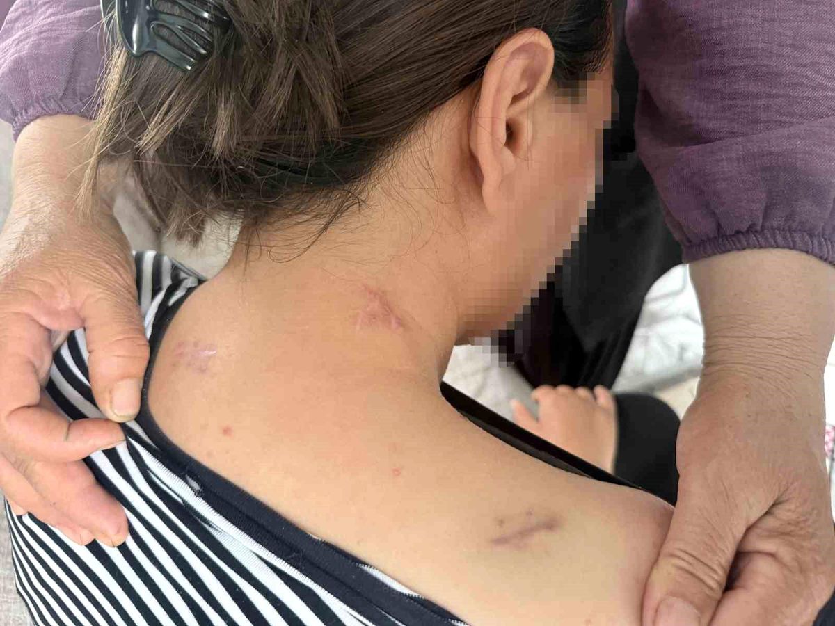 17 bıçak darbesi aldı, ölü numarasıyla kurtuldu, kocasının en ağır cezayı almasını istedi