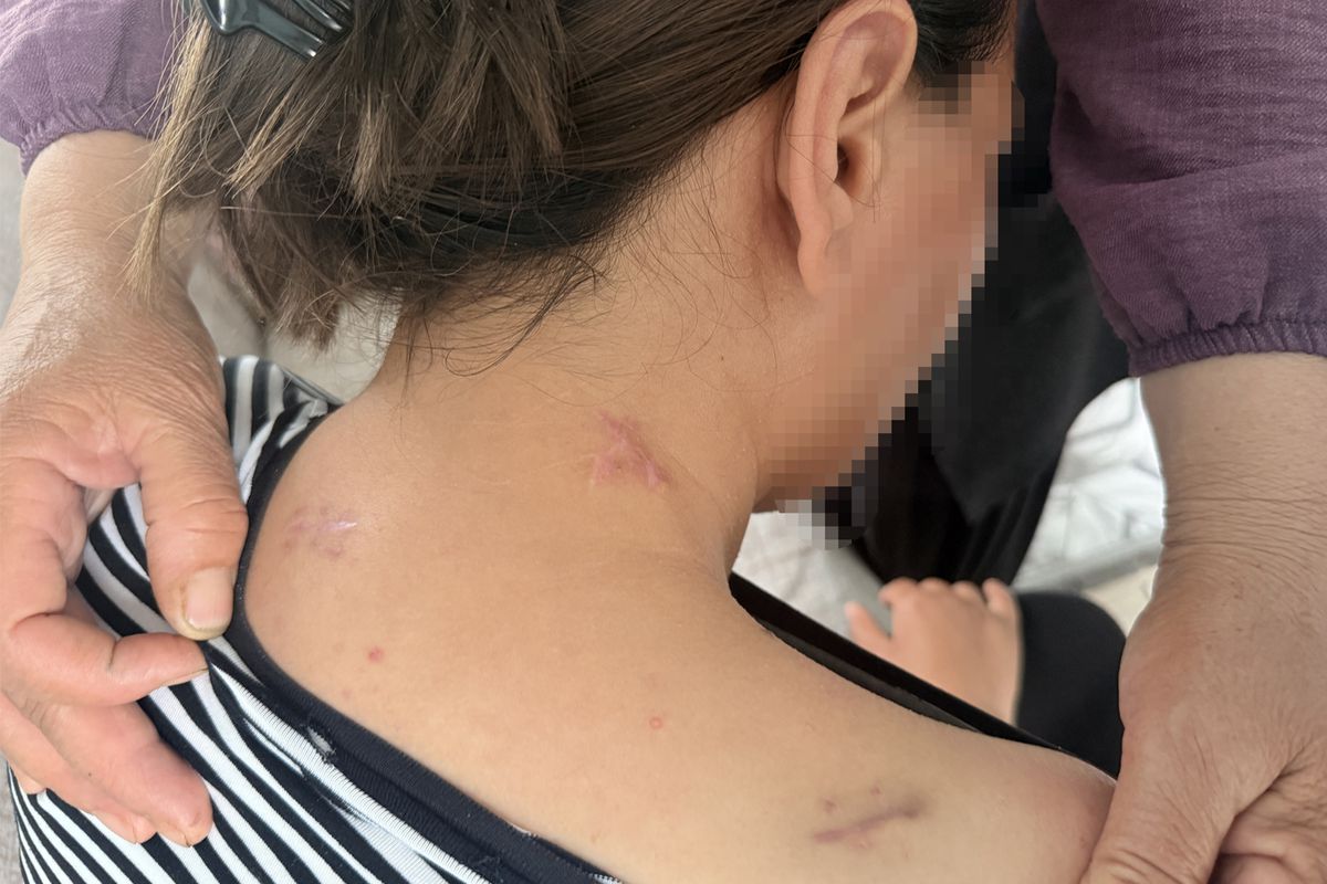Eşinin saldırdığı kadın 17 bıçak darbesi aldı, ölü numarasıyla kurtuldu