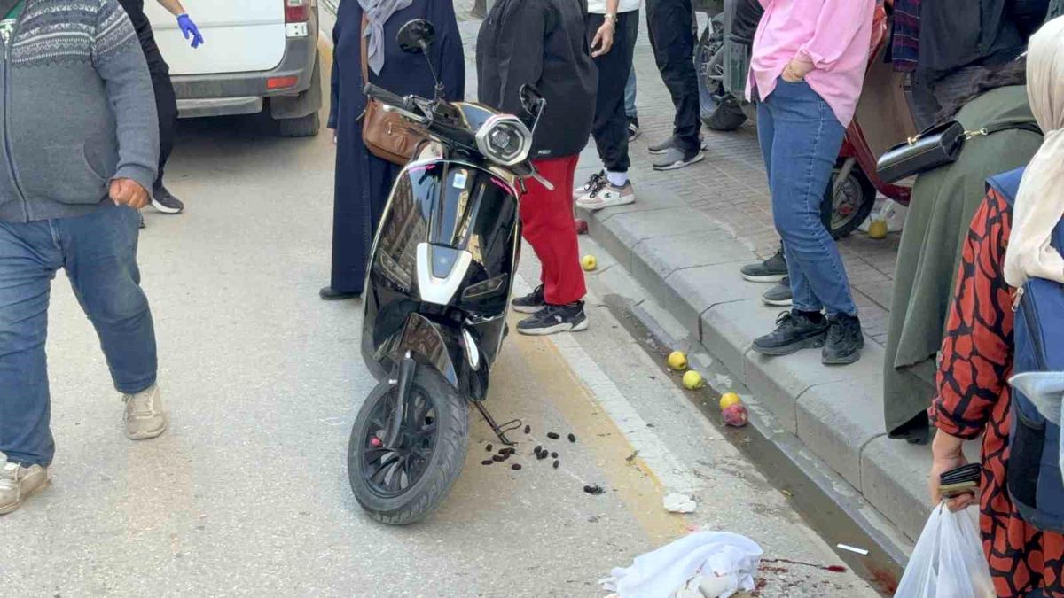 Scooterin çarptığı yaya yaralandı