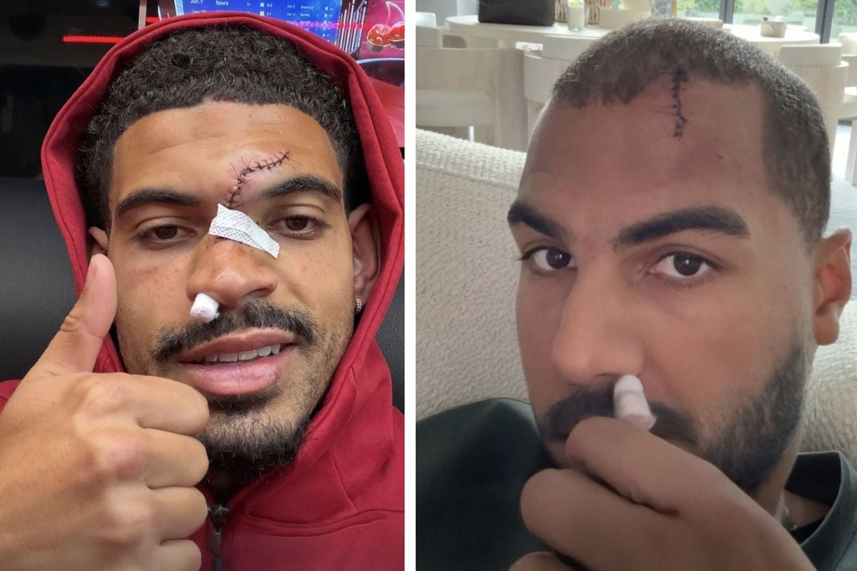 Kafa kafaya çarpışan Morgan Gibbs-White ve Robert Sanchez'in yüzünün son durumu korkuttu