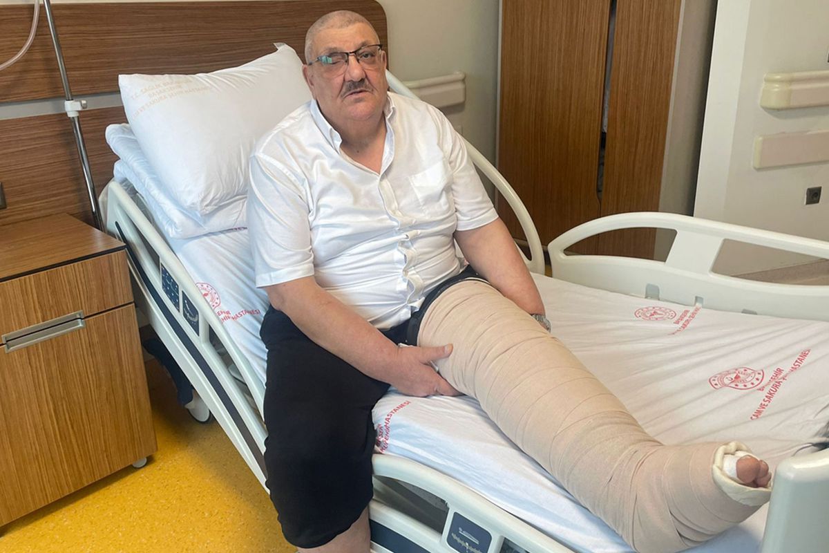 İstanbul'da fil hastasının 2 katına çıkan bacağındaki şişlik tedaviyle geriledi