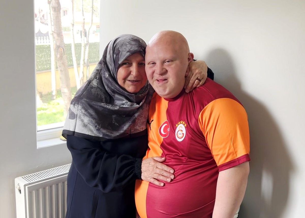 Down sendromlu annesinin sosyal alan ve anlayış isteği