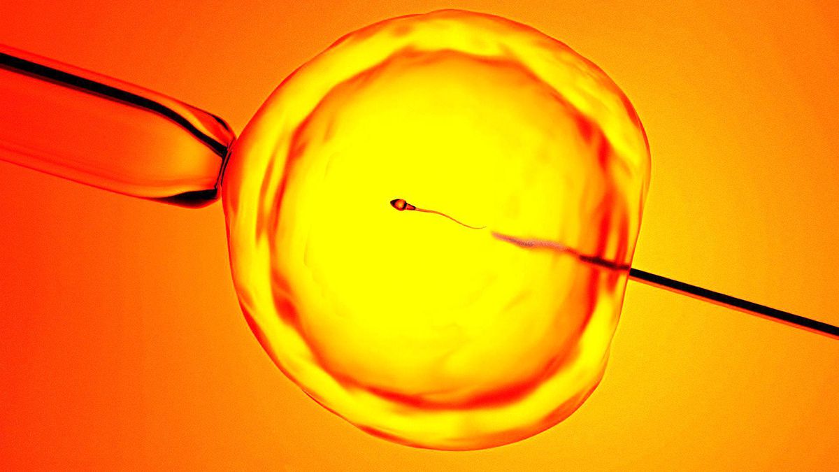 Kısırlık tedavisinde yeni umut: Yeni teknoloji yapay zekayla sperm buluyor