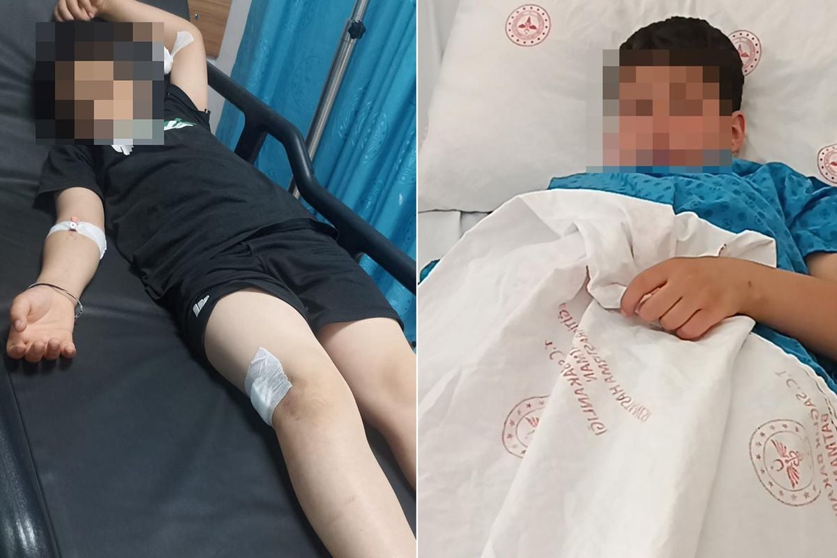 Çocukların elleri tetikte! 9 yaşında parkta vuruldu