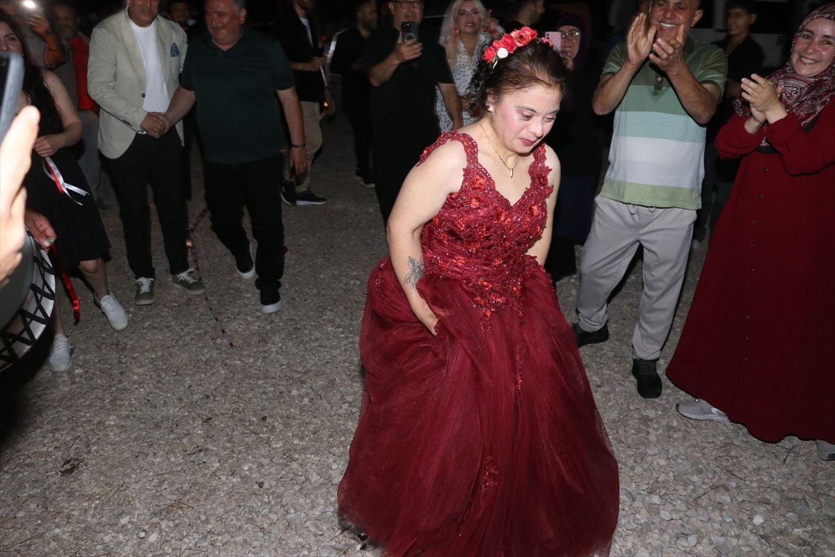 Adana'da down sendromlu Birdane'nin gelinlik giyme hayali gerçek oldu