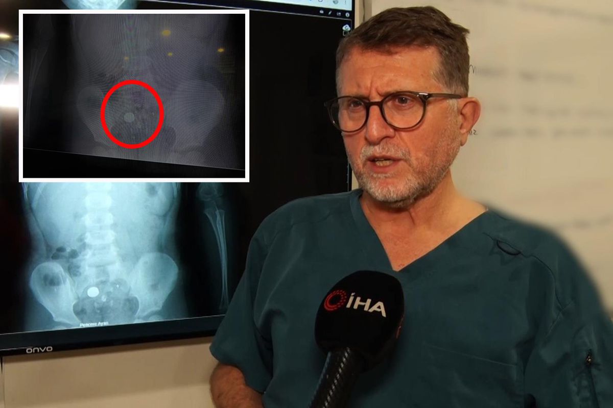 Şeker sanıp yuttu, pil olduğu filmde ortaya çıktı: Ölüme kadar götürebiliyor