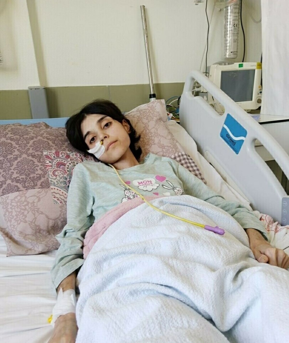 Ünzile, ameliyat sonrası protein emilim bozukluğu nedeniyle 18 yaşına 30 kiloyla giriyor