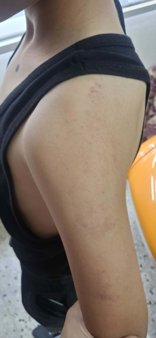 صورة الطفل الذي ضربه والده
