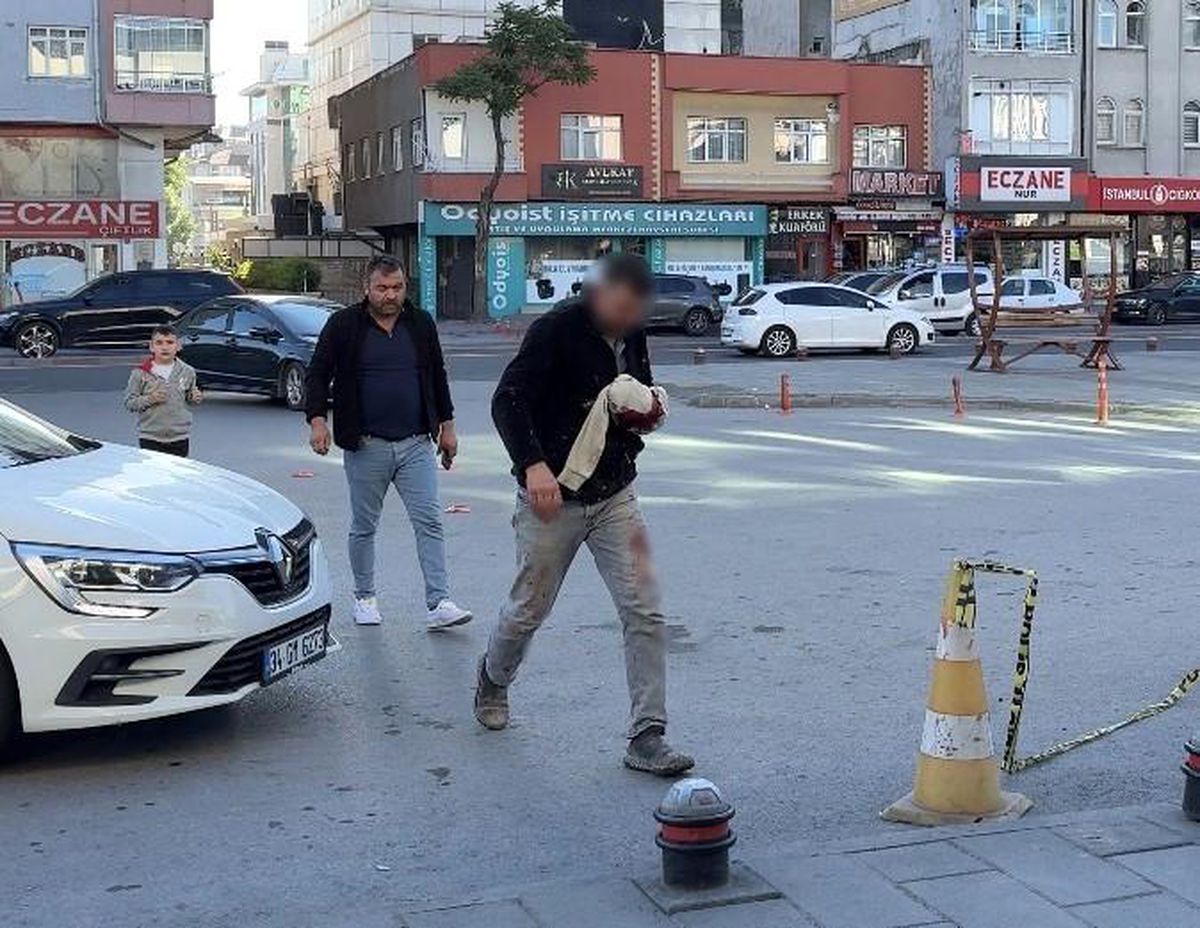 Kayseri'de acemi kasaplar hastaneye koştu