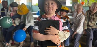 Türk STK'ler Tanzanya'daki albino çocuklara bayram sevinci yaşattı