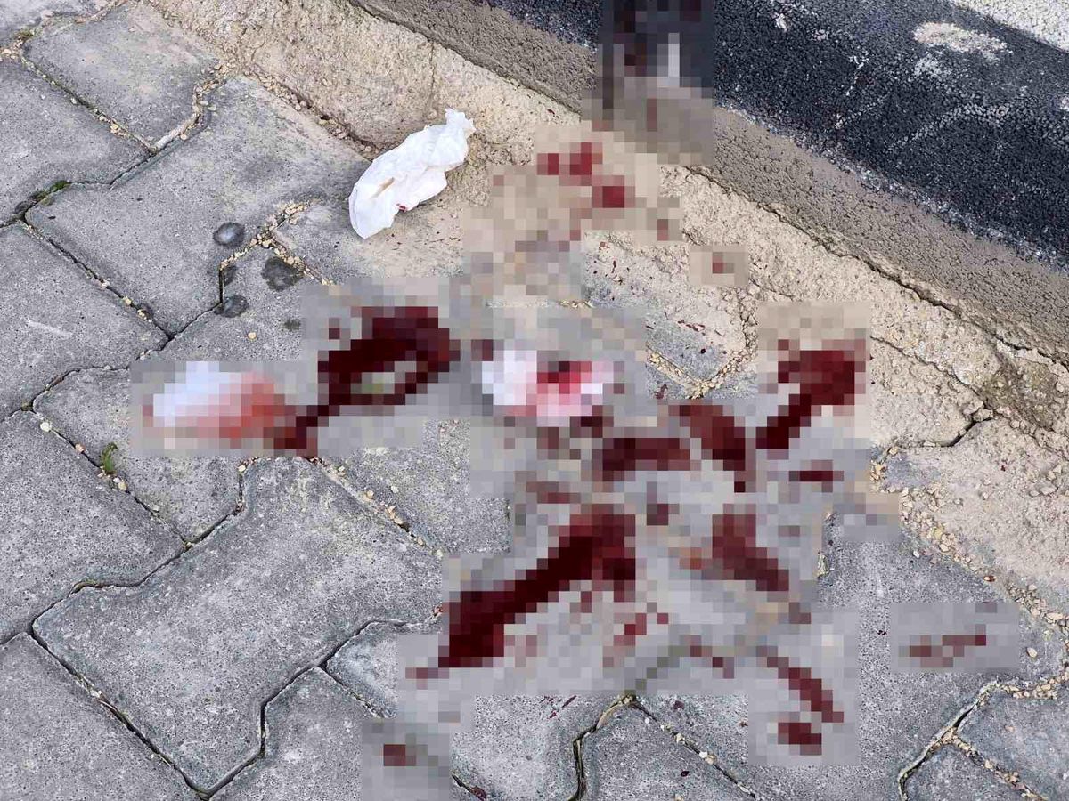 16 yaşındaki çocuk caddede bacağından bıçaklandı