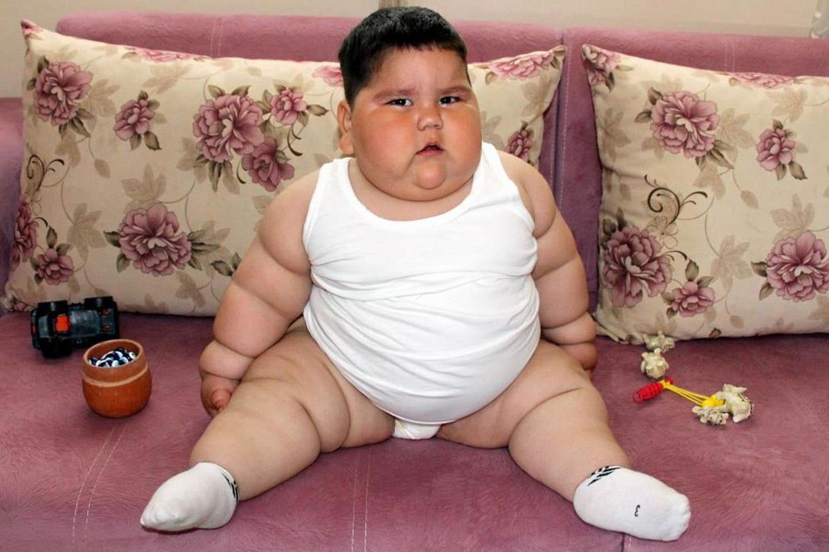5 yaşındayken 90 kiloydu! Minik Yağız'ın 6 yıl sonraki görenler inanamıyor