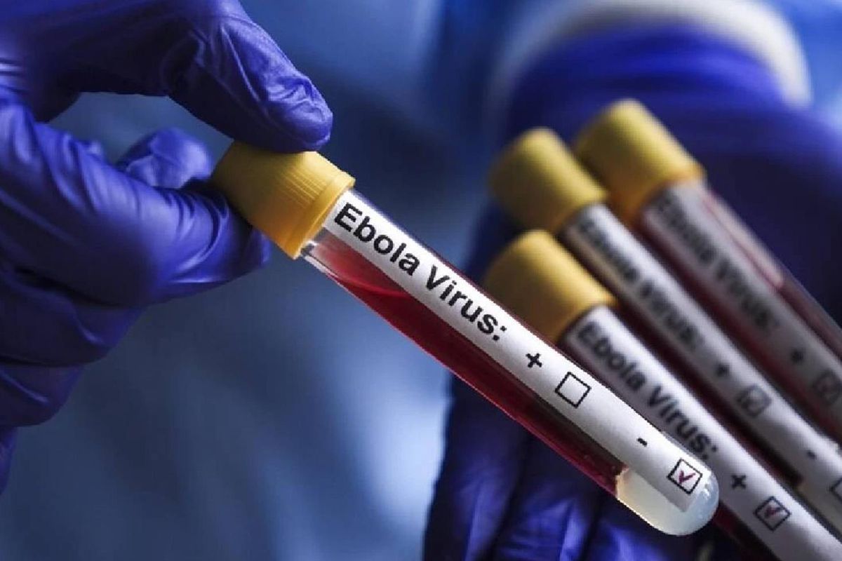 KKTC'den Ebola virüsüne karşı yeni tedbirler
