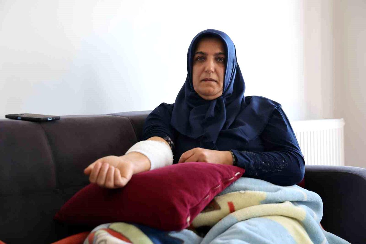 Köpek saldırısına uğrayıp yaralanan kadın o anları anlattı