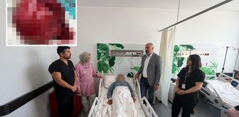 Niğde'de bir hastanın vücudundan 7 kiloluk tümör çıkarıldı