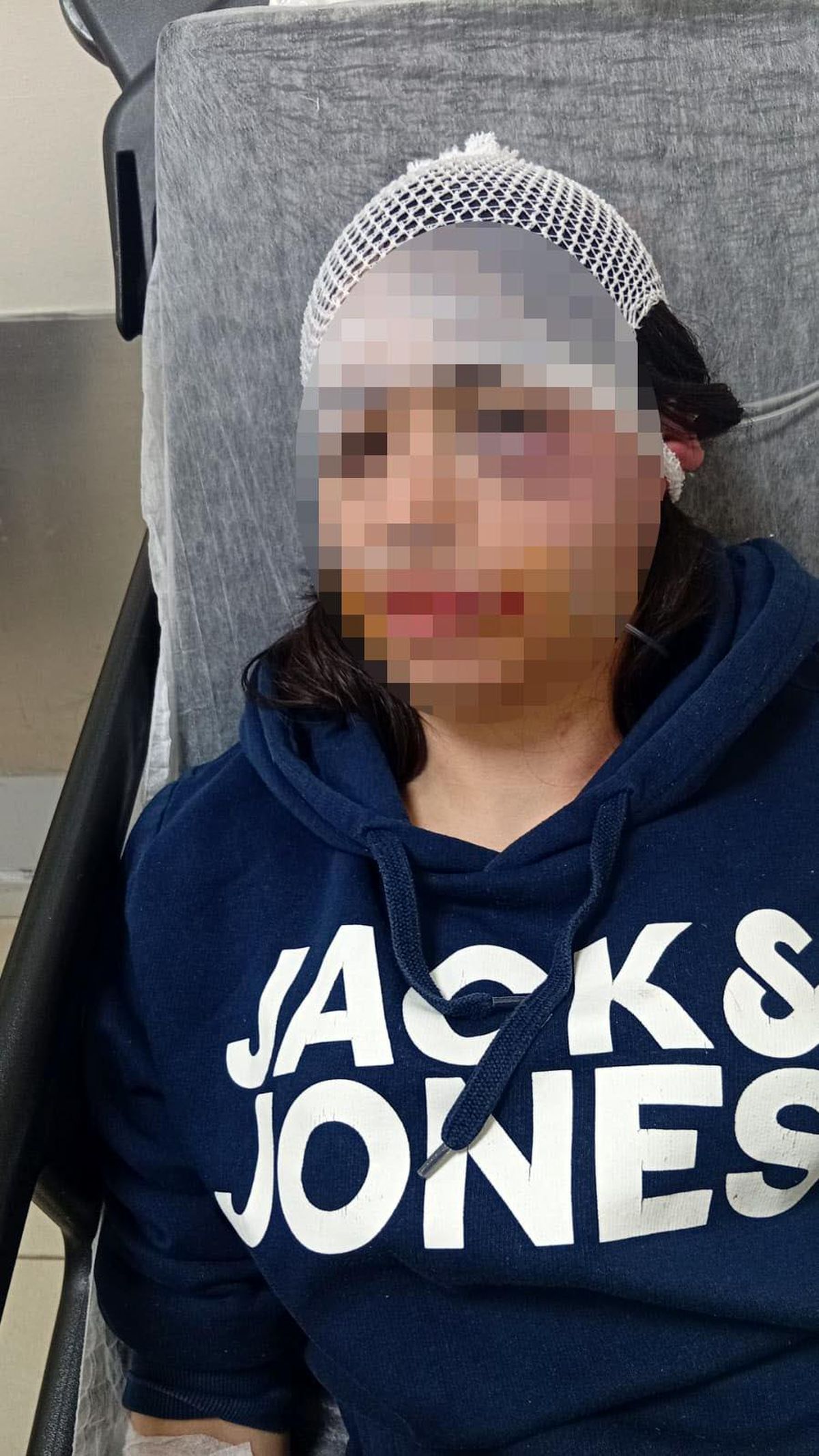Ayrılık kararını kabullenemeyip kız arkadaşını darbeden sanı