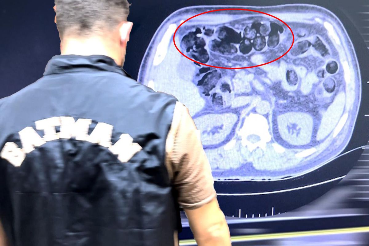 Şüpheli hareketleri ele verdi! Midesinden çıkanlar şaşkına çevirdi