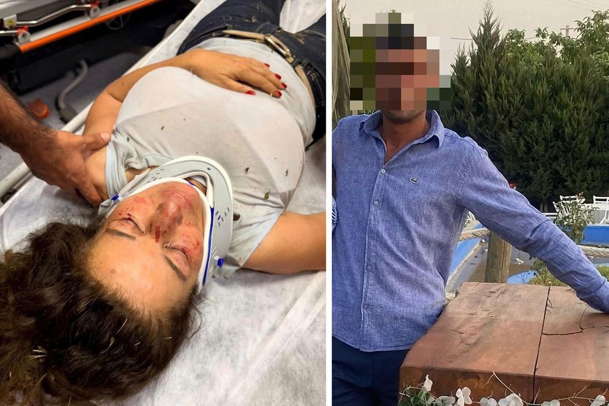 İzmir'de hayvanlara yardım için çağrılan eczacı, bir adreste saldırıya uğradı.