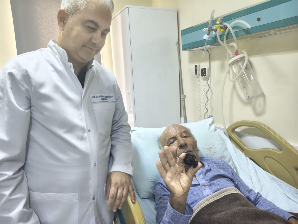 Mersin'de 67 yaşındaki hastanın mesanesinden 4 santimetrelik taş çıkarıldı