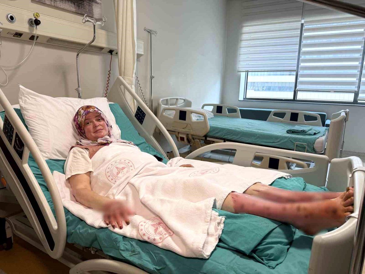 Karavanda patlama: Anne alev topuna döndü, 4 kişi ölümden döndü