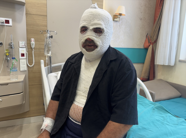 hararet yapan araca acele muda 20004118 4988 1 m