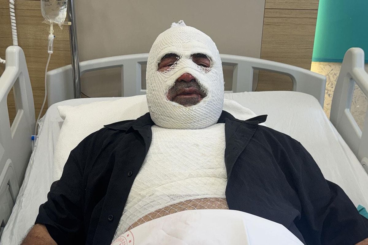 Araç sahipleri dikkat: Kaputu açmak hayatının hatası oldu