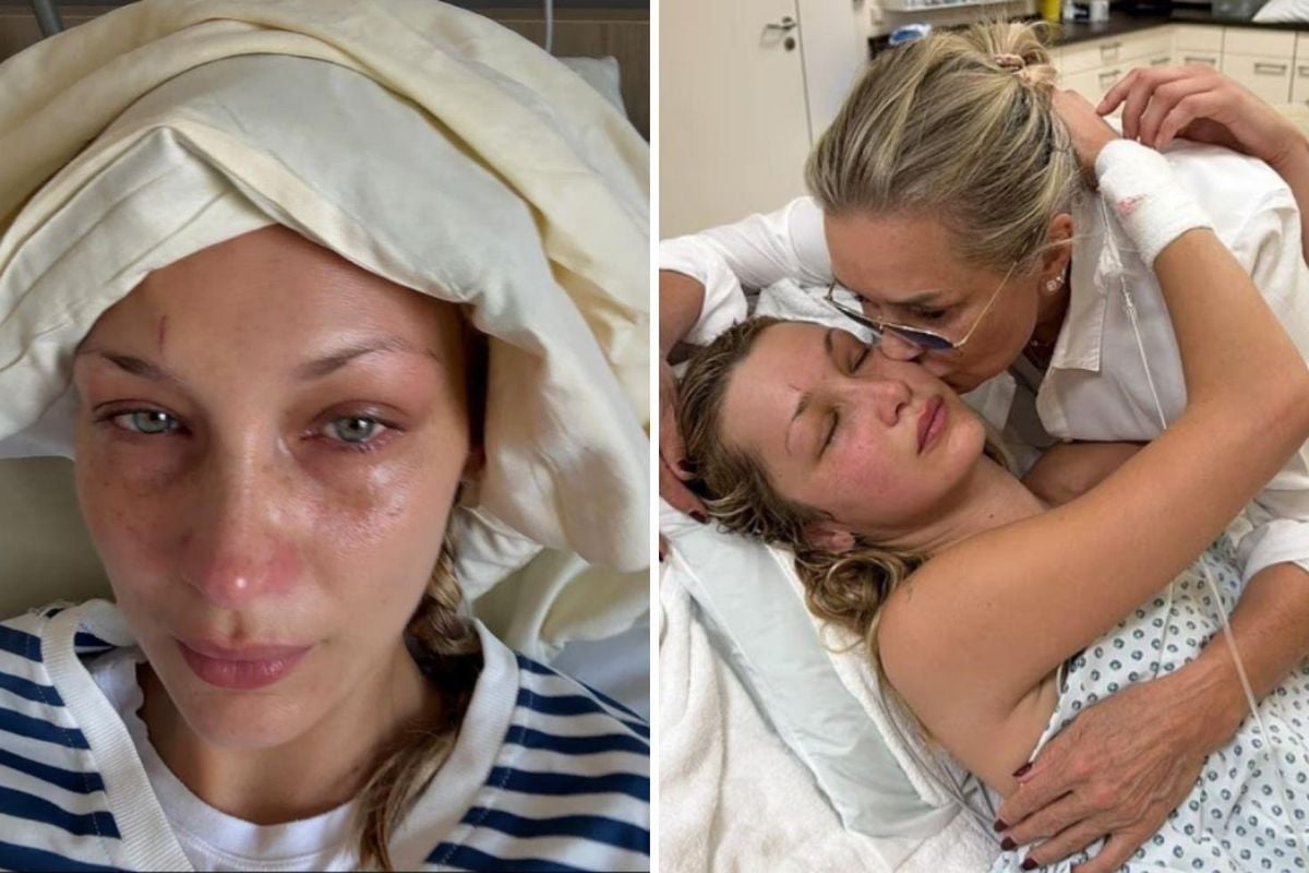Bella Hadid'in Lyme hastalığıyla ilgili paylaşımı.