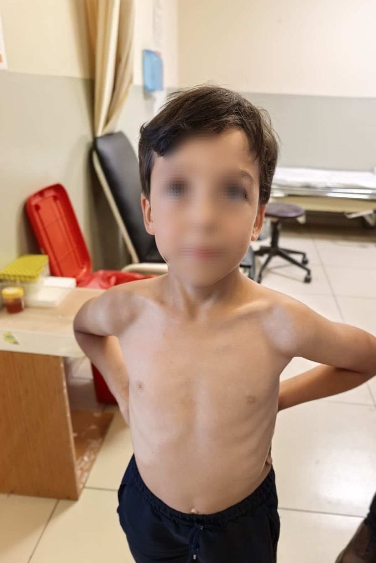 İnegöl'de bir çocuğun göğsüne yapışan kenenin sağlık ekiplerince çıkarılması anı.