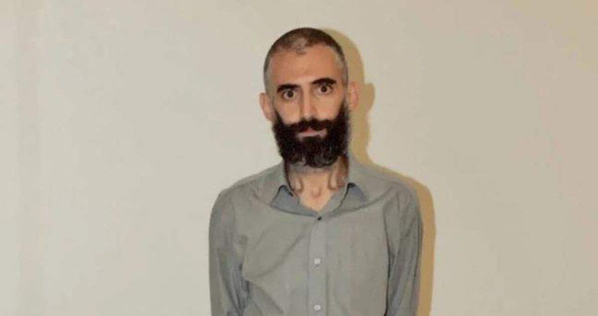 Gürkan Türkoğlu kimdir? Gürkan Türkoğlu neden öldü?