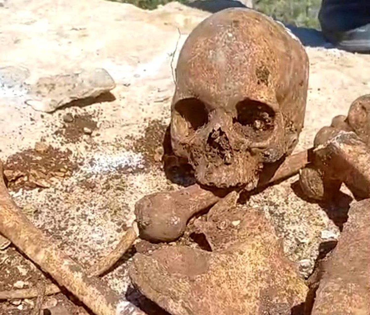 Malatya'nın Hekimhan ilçesinde bir inşaatın temel kazısı sırasında bulunan insan kemikleri ve kafatası parçası.