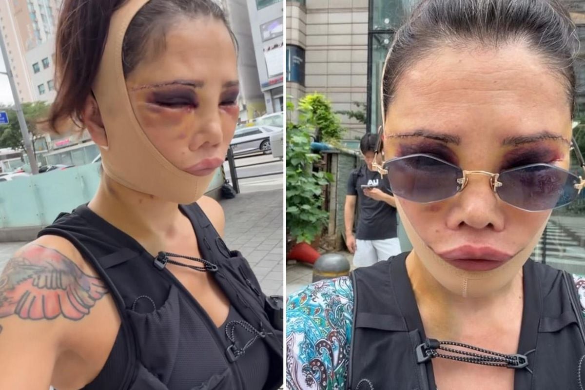 Eski Survivor yıldızı Didem Ceran tanınmaz halde