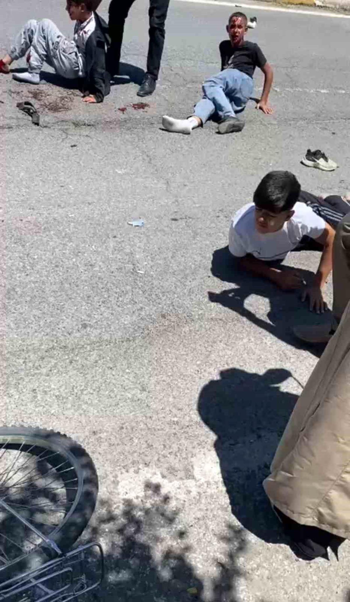 Patnos'ta otomobilin çarptığı 3 bisikletli çocuk yaralandı