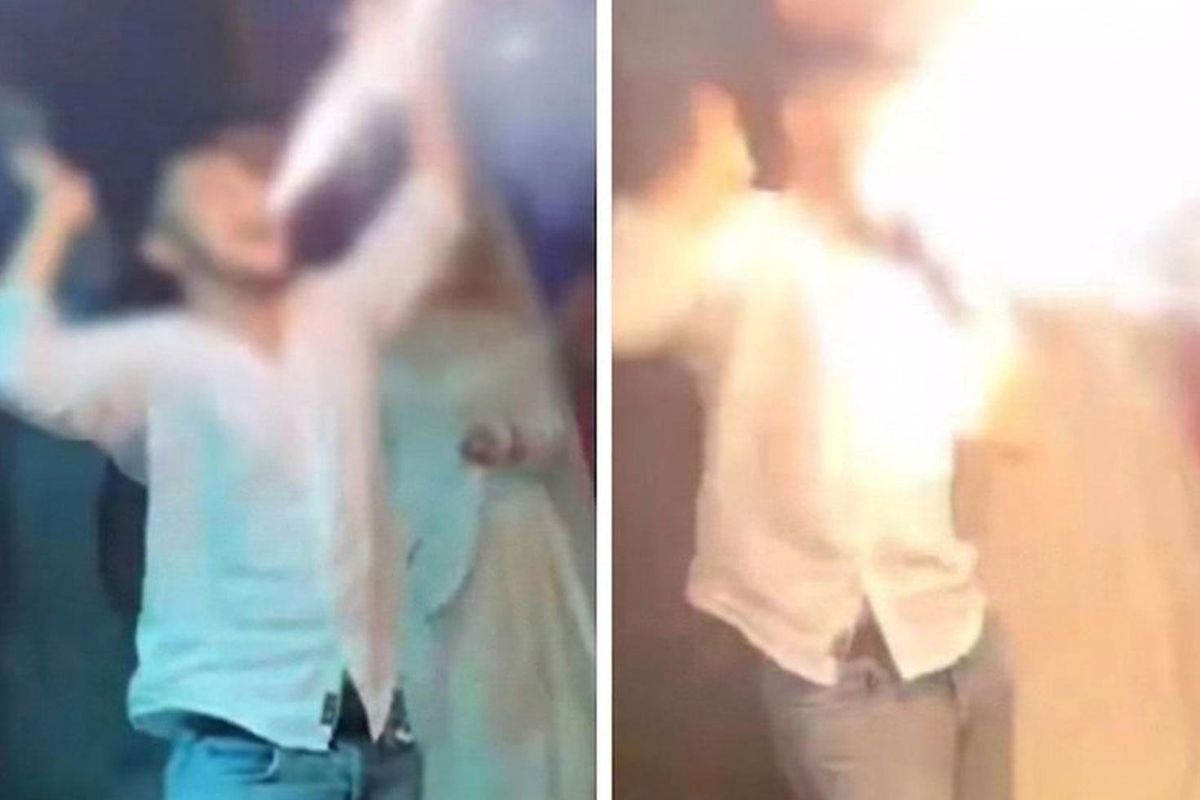 Ankara'da düğünde meşale patladı: Genç yaralandı