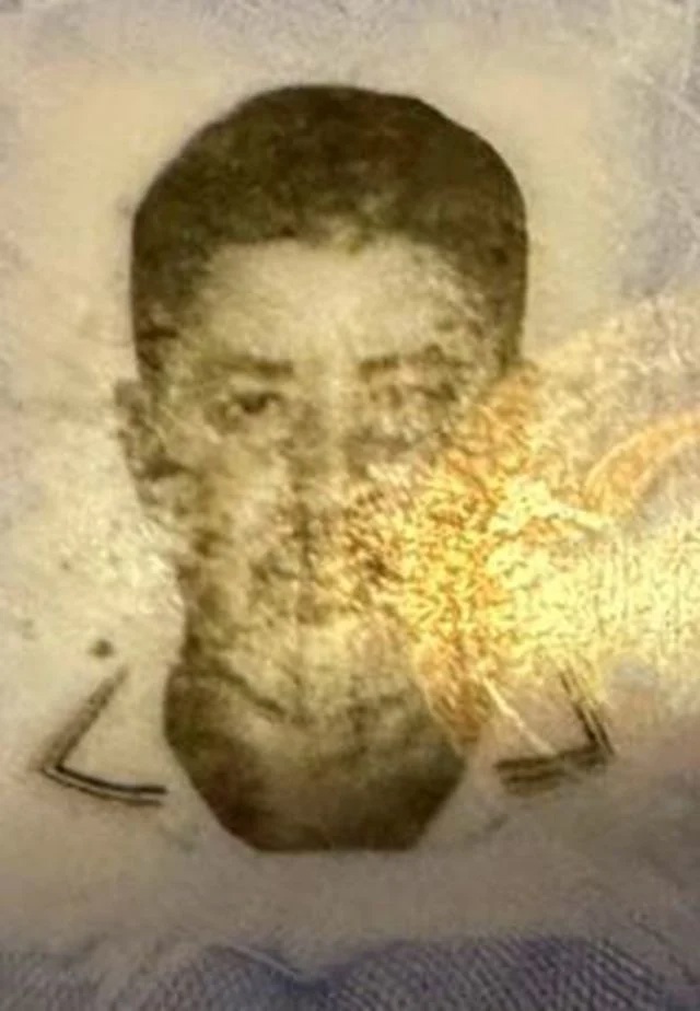 kadin doktorun sedye uzerindek 20096930 8433 1 m