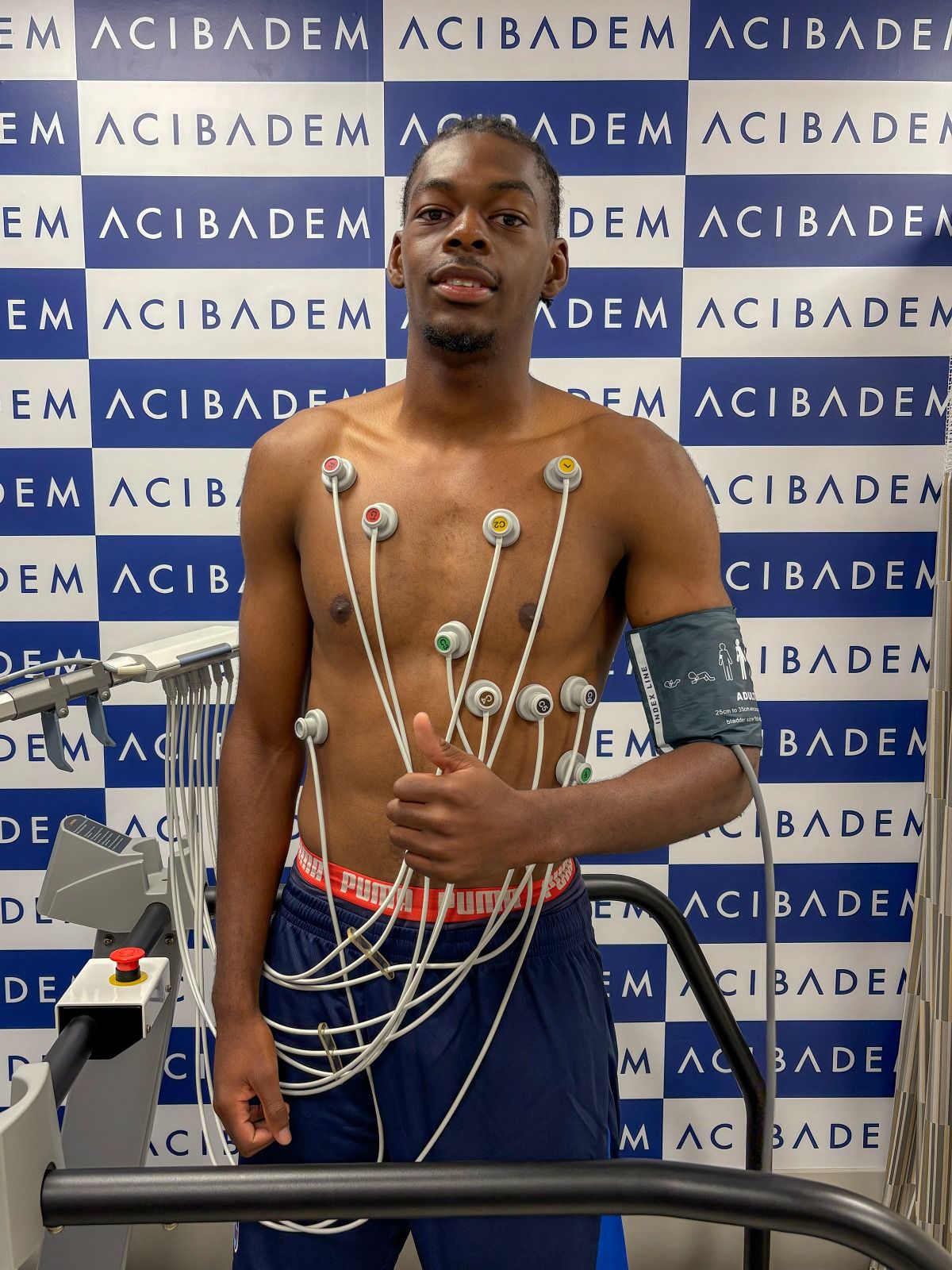 Trabzonspor, Rene Mitongo transferini resmen açıkladı