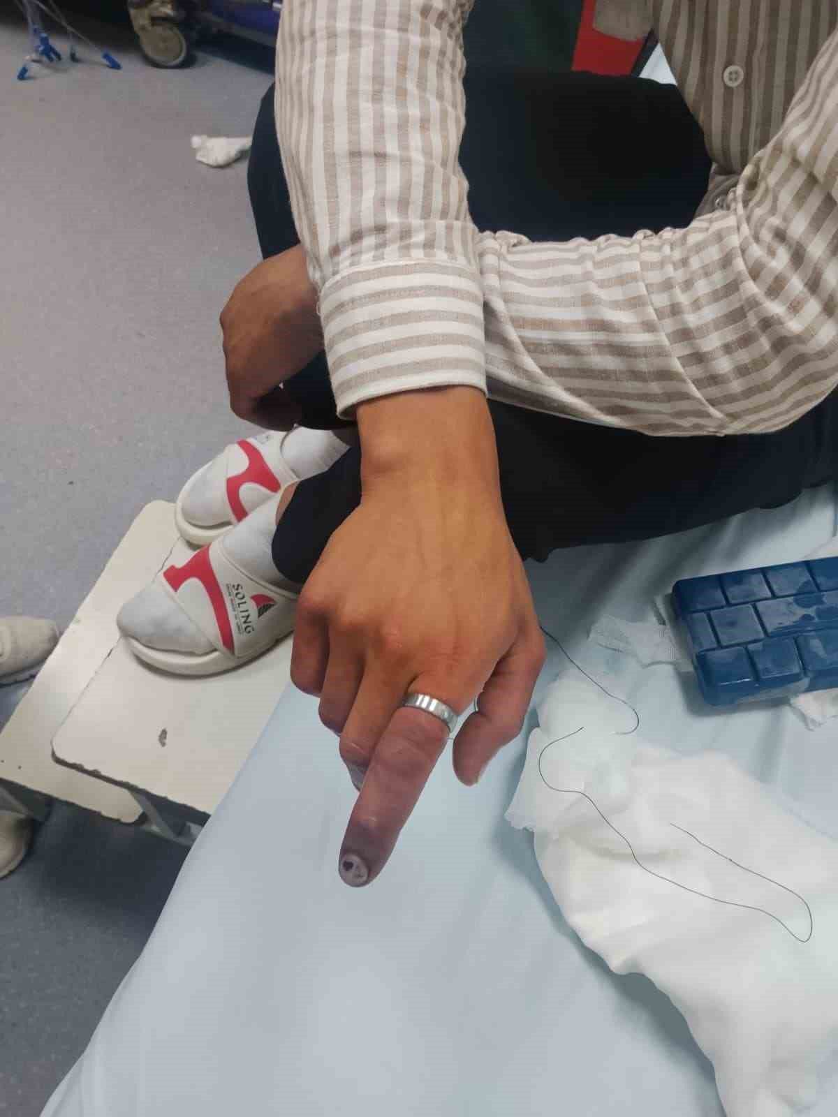 Parmağında sıkışan yüzük itfaiye ekiplerince kesildi