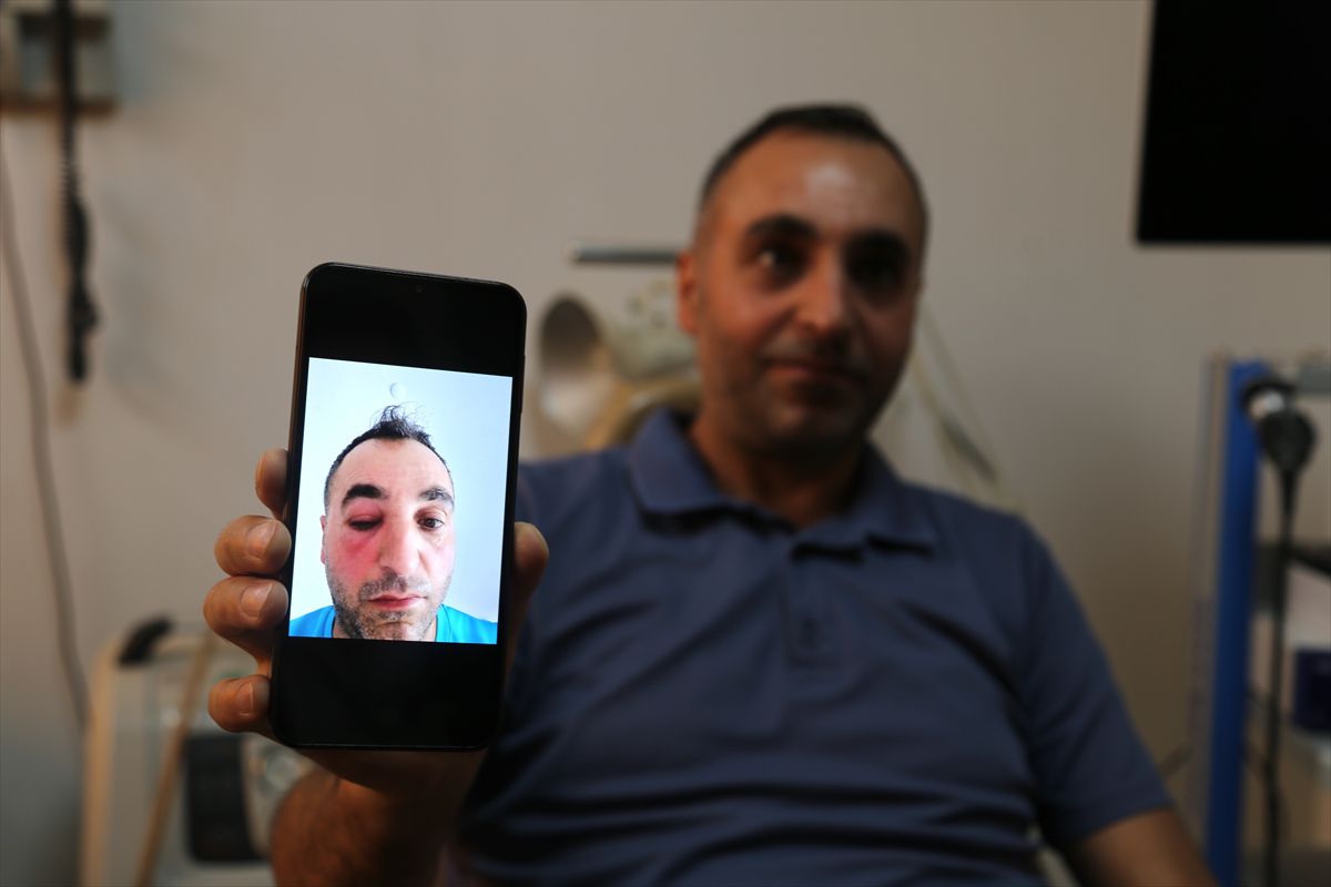 Bitlis'te kapalı yöntemle gözyaşı kanalı ameliyatı
