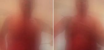 Canlı yayında bıçakla kendine zarar veren fenomen hastaneye kaldırıldı