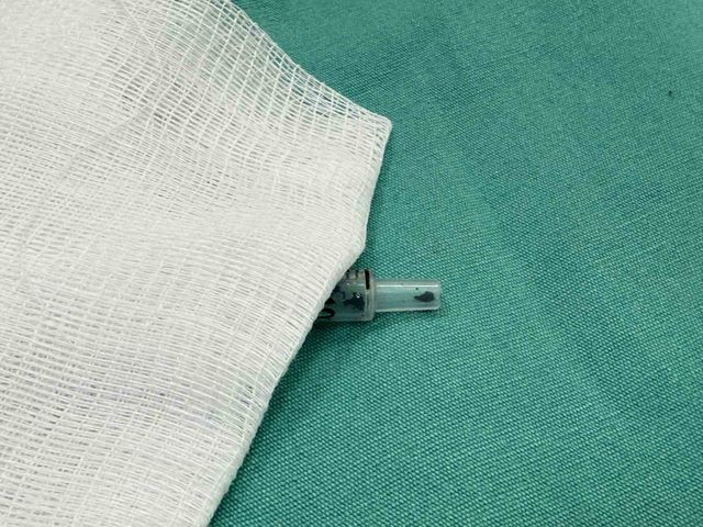Matkap kullanırken neredeyse kör oluyordu 3 matkap kullanirken firlayan vida parcasi gozu 20127208 o