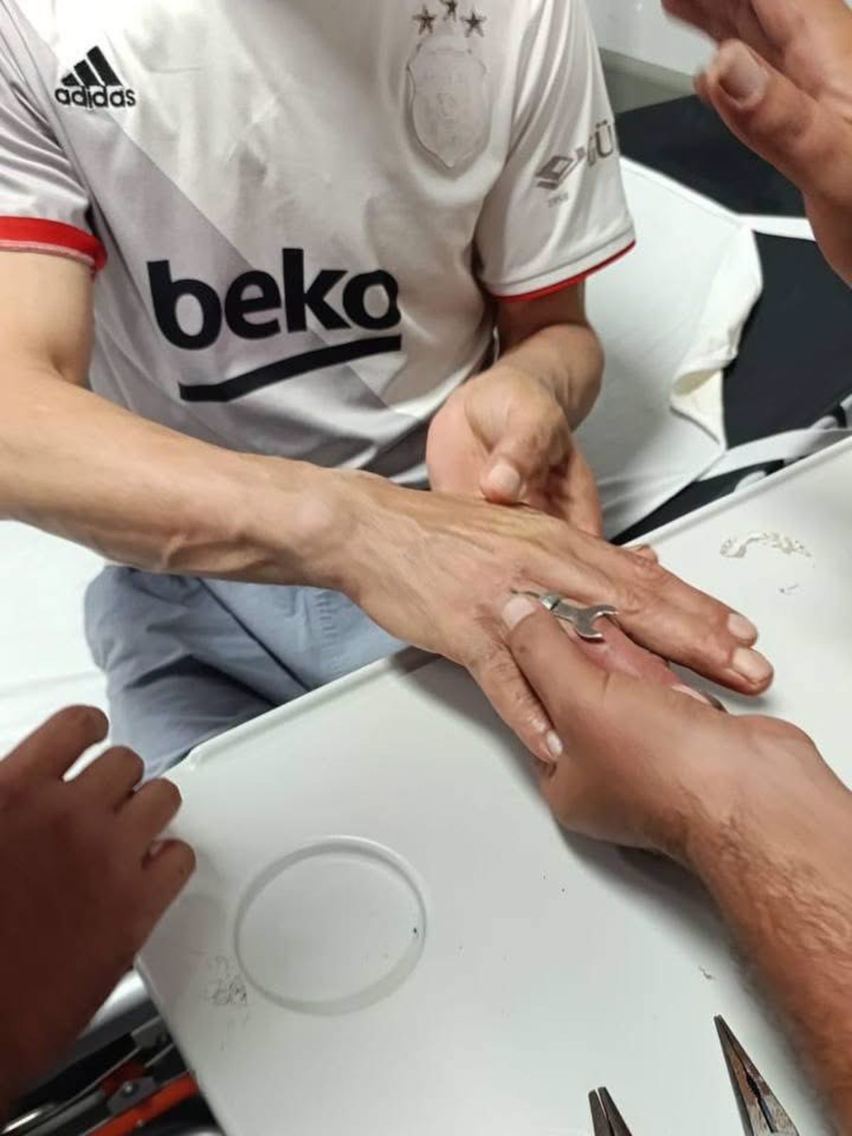 Hatay'da Parmağa Sıkışan Yüzük İtfaiye Tarafından Kesilerek Çıkarıldı