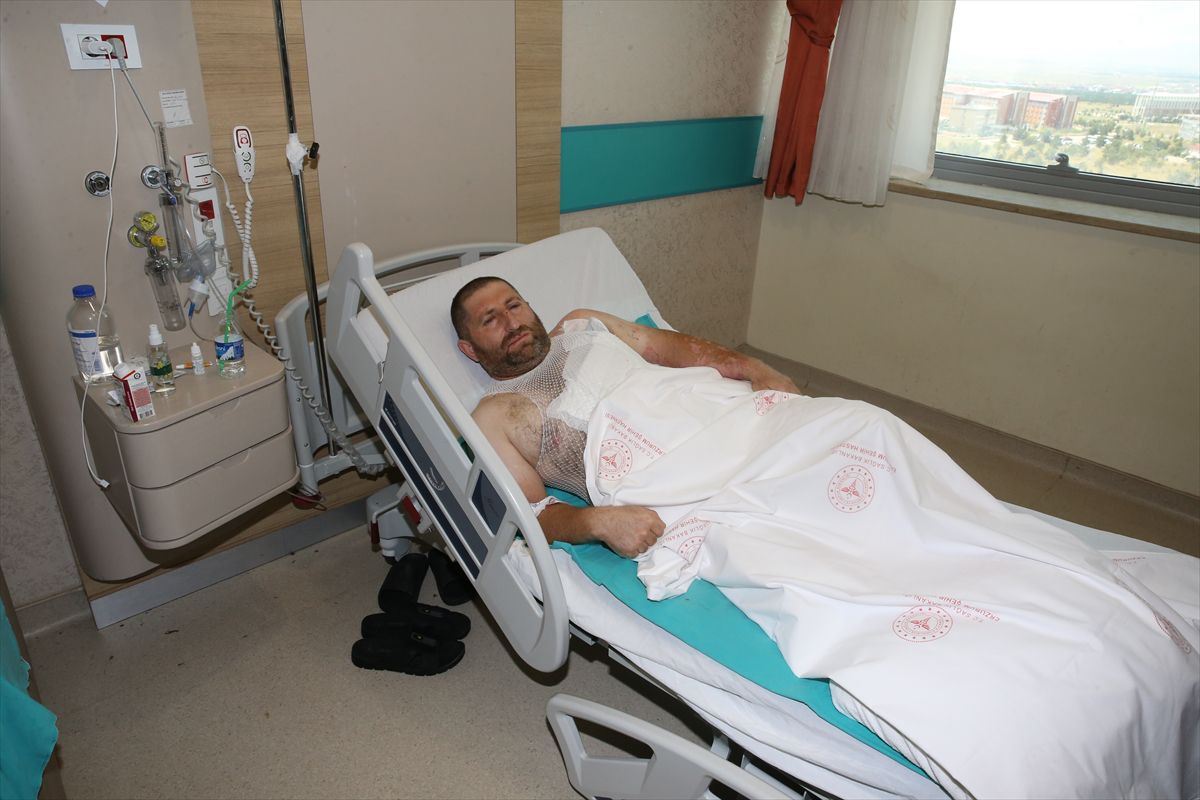 Demir ustası yüksek gerilim akımına kapıldı, 15 gündür tedavi görüyor