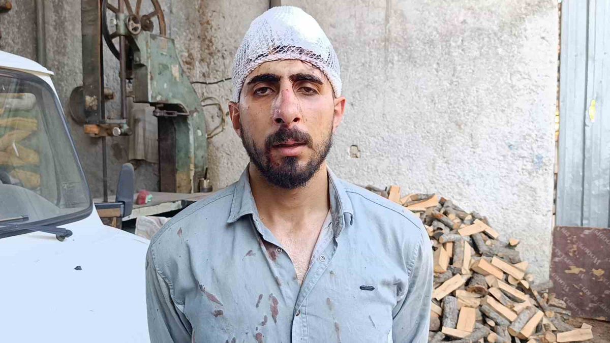 Yavaş Sürüş Nedeniyle Darp: Sürücünün Burnu Kırıldı