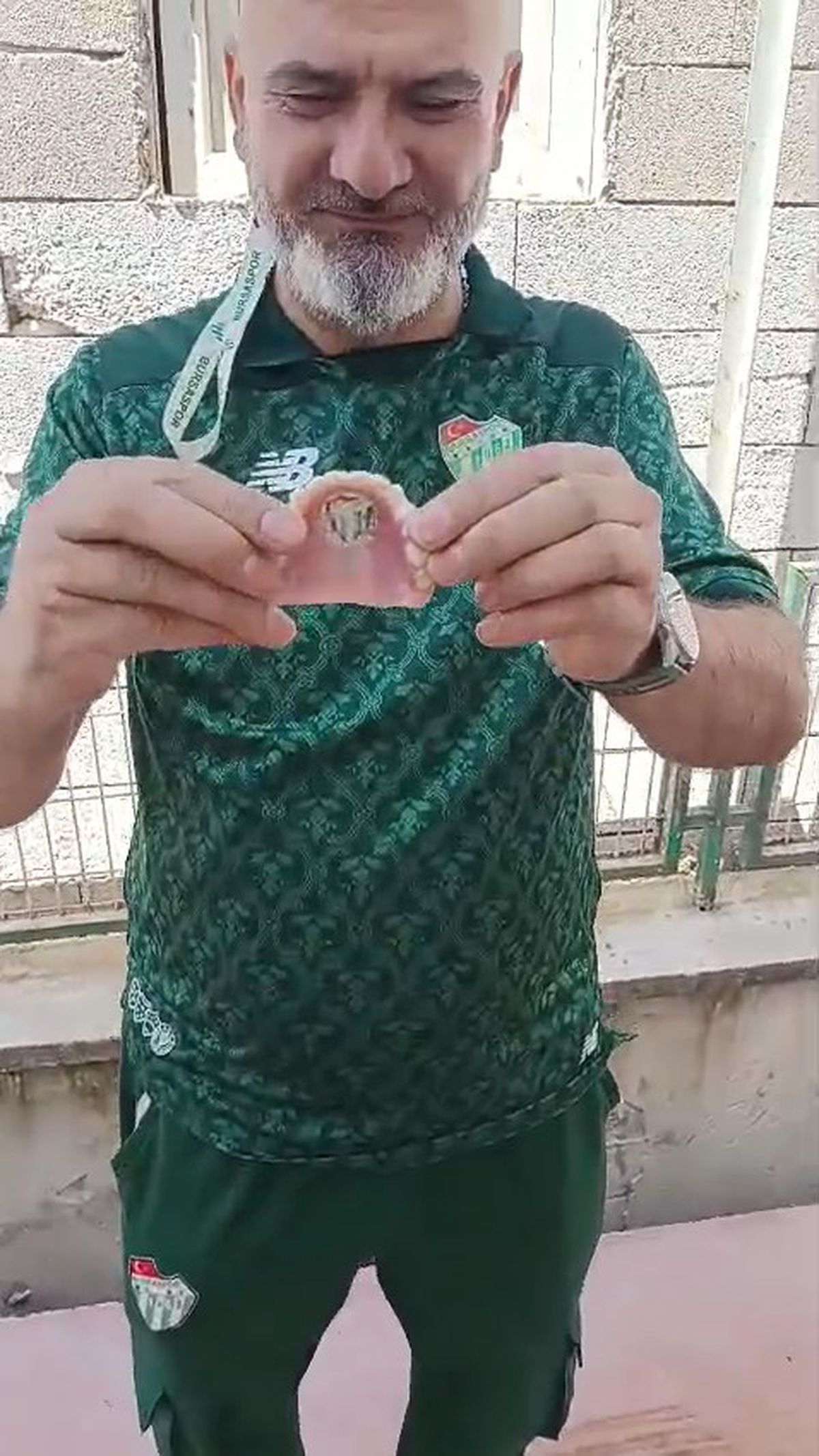 Bursaspor Tutkunu Dişine Amblem Yaptırdı