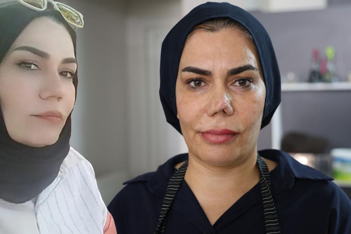 Burun estetiği faciayla sonuçlandı: Kadının hayatı kabusa döndü
