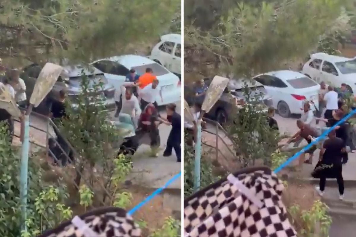 İddia vahim! Köpeğini gezdiren küçük kızı bıçakladı, annesinin kolunu kırdı