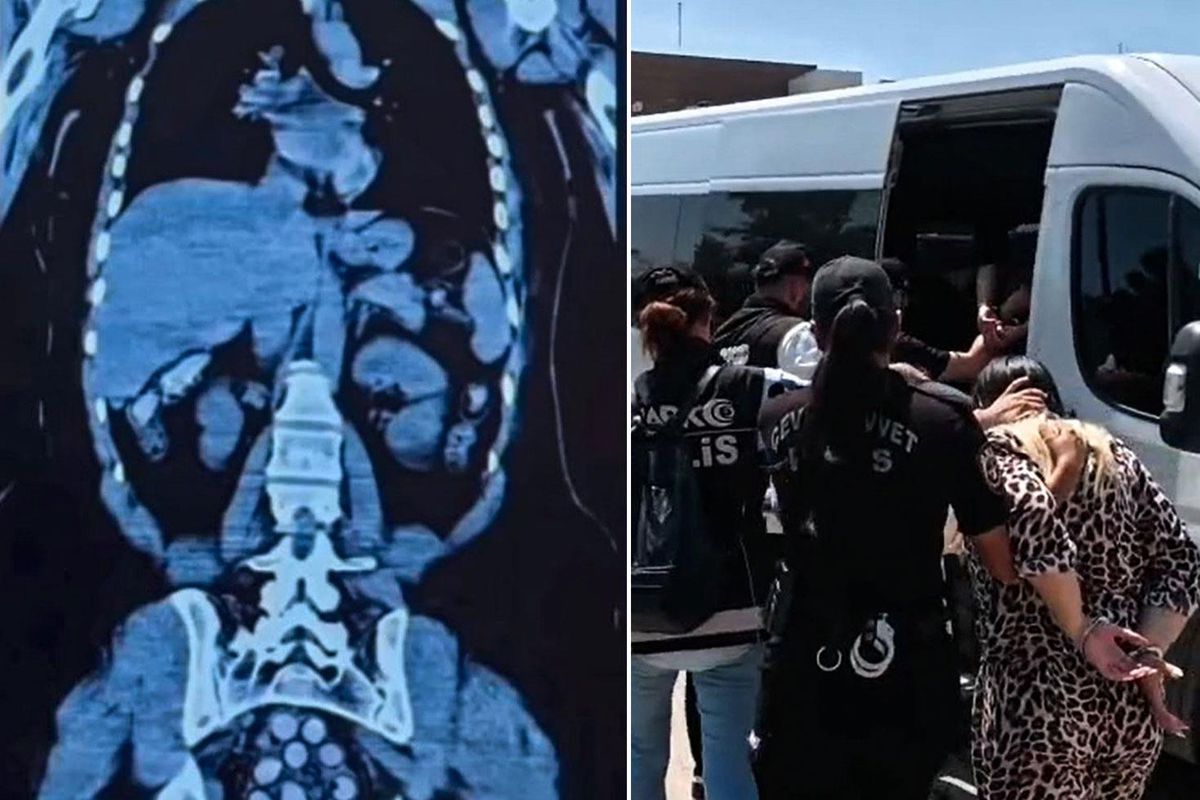 Midesinde 1,5 kilo metamfetaminle yakalanan 2 kadın tutuklandı