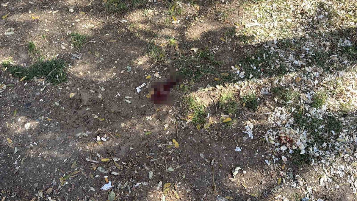 Parkta Bıçaklı Saldırı: Şüpheli Kısa Sürede Yakalandı