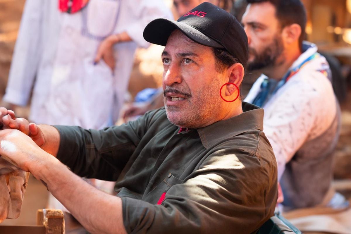 Cem Yılmaz'ın kalp krizi sonrası herkes bu detaya takıldı